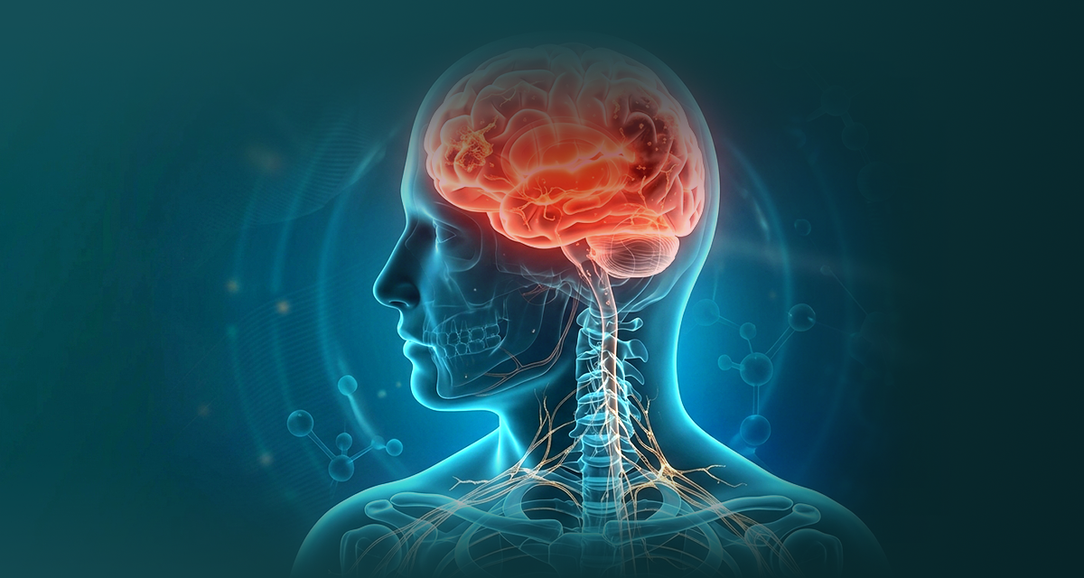 Choroby neurodegeneracyjne mózgu. Zespoły otępienne w codziennej praktyce. 72026